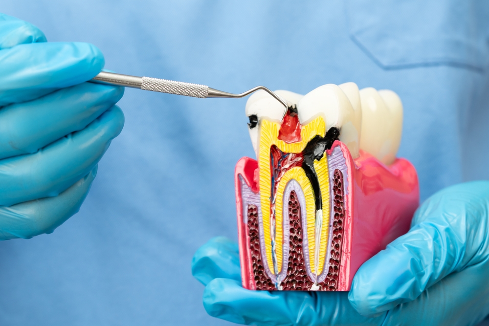 why root canal therapy is safer than ever in 2026